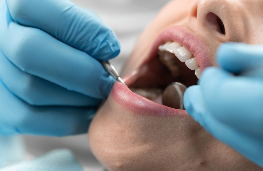 Tratamiento de la avulsión dental