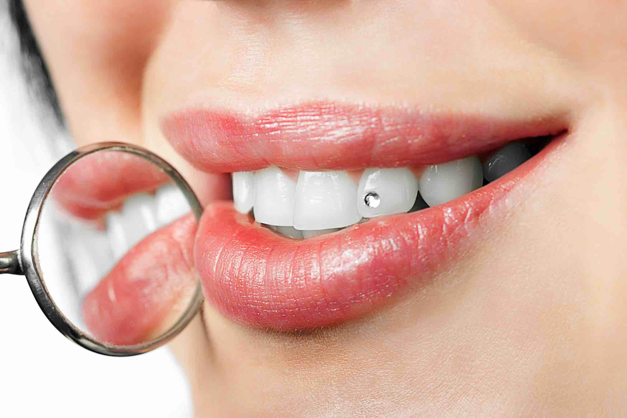 Sonrisas brillantes adornos