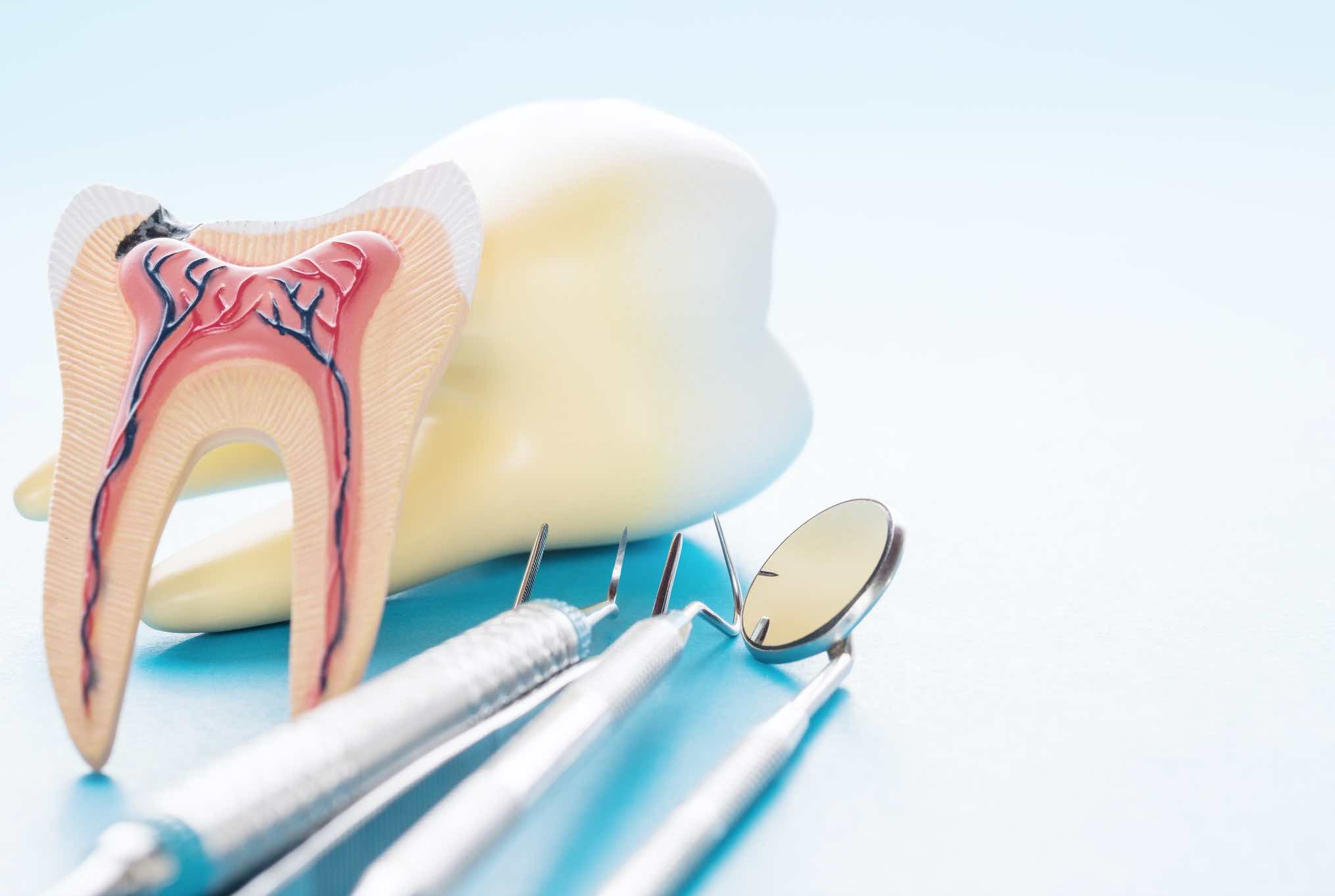 Nervio dental