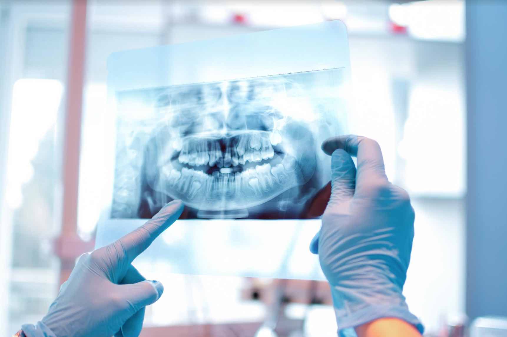 cirugía maxilofacial