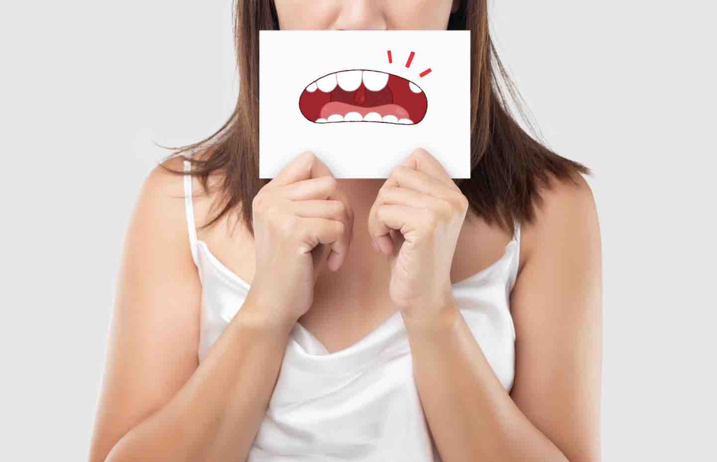 Reconstrucción dental de una mujer
