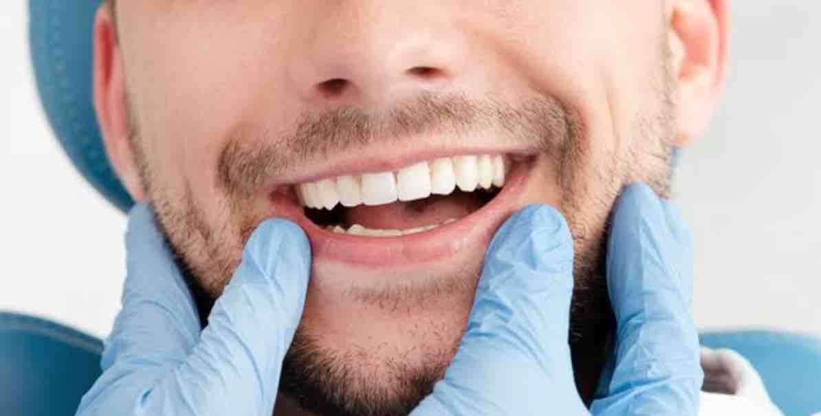 Hombre con sonrisa gingival