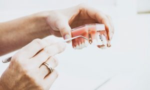 Fallos de los implantes dentales