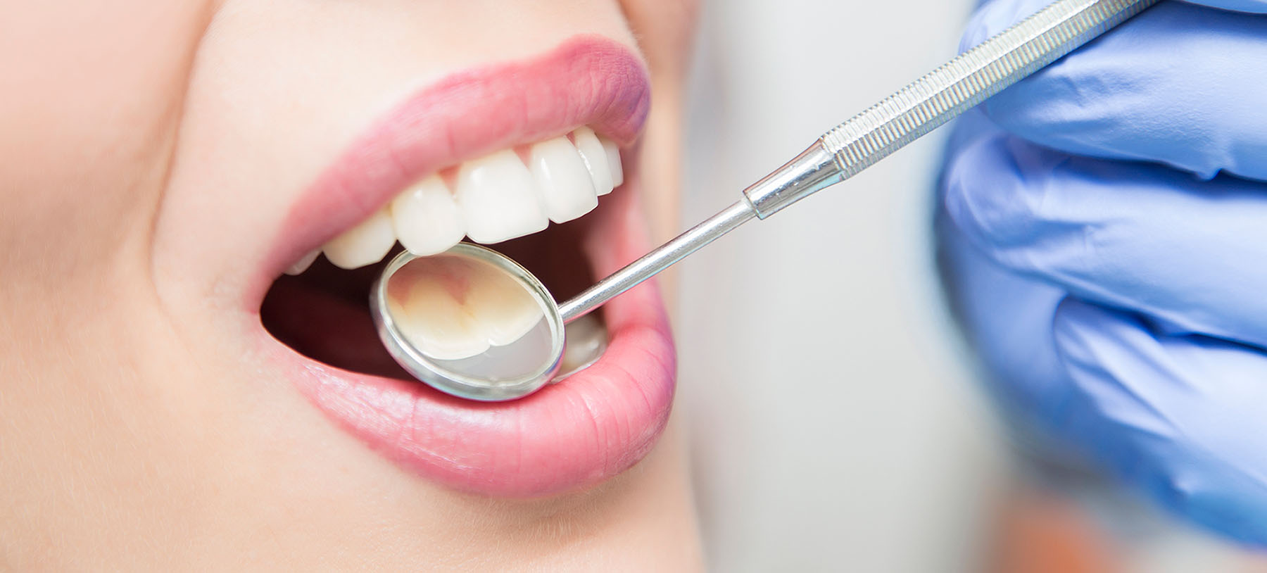 lila recoger transferencia de dinero Limpieza Dental Avanzada ▷ ¡Consulta Precios! - Vitaldent