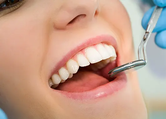 Limpieza Dental ▷ ¡Consulta Precios! - Vitaldent