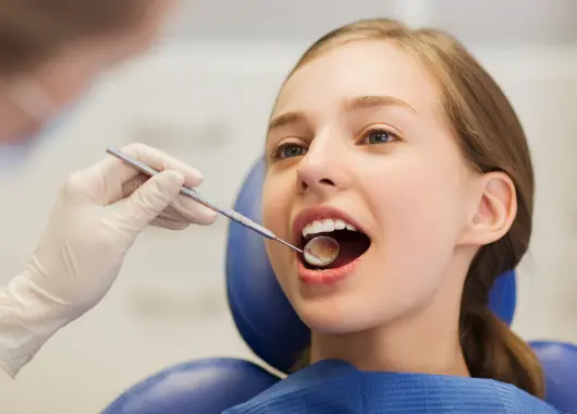 Caries dentales*