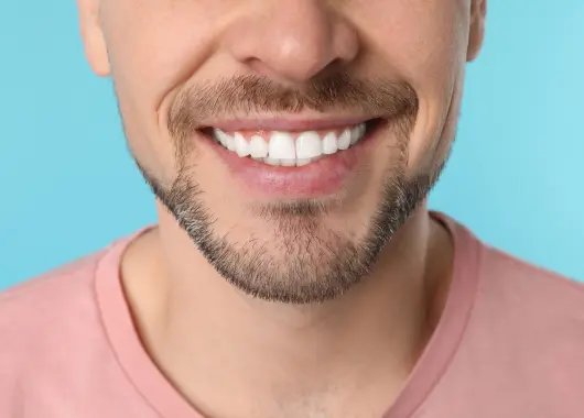 Reconstrucción dental*